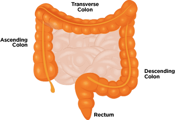 How ulcerative colitis may affect you.